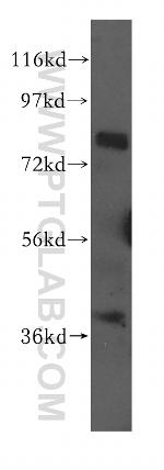 CBFA2T2 Antibody in Western Blot (WB)