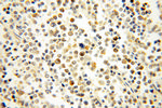 NSD3 Antibody in Immunohistochemistry (Paraffin) (IHC (P))