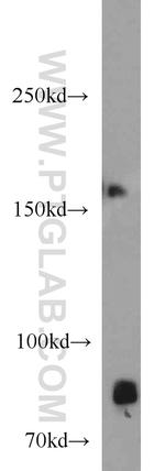 NSD3 Antibody in Western Blot (WB)