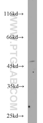 FH Antibody in Western Blot (WB)