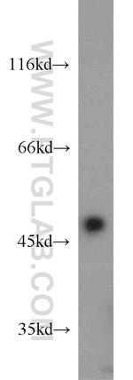 FH Antibody in Western Blot (WB)