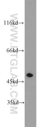 FH Antibody in Western Blot (WB)