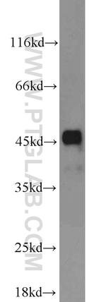 FH Antibody in Western Blot (WB)