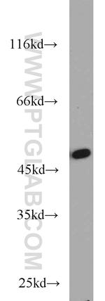 FH Antibody in Western Blot (WB)