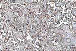 FH Antibody in Immunohistochemistry (Paraffin) (IHC (P))