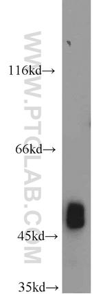 FH Antibody in Western Blot (WB)