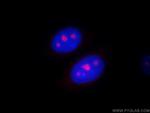 PSMC4 Antibody in Immunocytochemistry (ICC/IF)