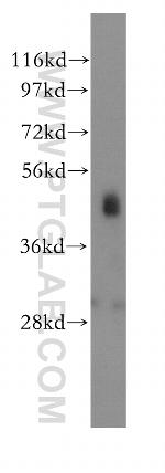 PSMC4 Antibody in Western Blot (WB)