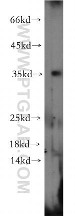 NMNAT1 Antibody in Western Blot (WB)