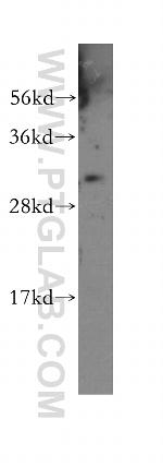 LENG1 Antibody in Western Blot (WB)