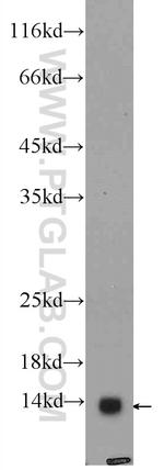 COX7A2L Antibody in Western Blot (WB)