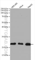 RAB9A Antibody in Western Blot (WB)