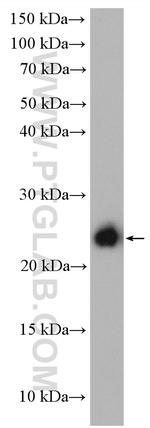 RAB9A Antibody in Western Blot (WB)