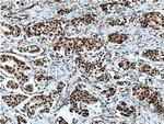 HNRNPK Antibody in Immunohistochemistry (Paraffin) (IHC (P))