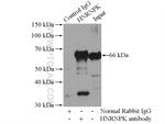 HNRNPK Antibody in Immunoprecipitation (IP)