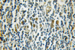 HAT1 Antibody in Immunohistochemistry (Paraffin) (IHC (P))
