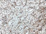 GRK6 Antibody in Immunohistochemistry (Paraffin) (IHC (P))