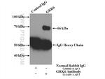 GRK6 Antibody in Immunoprecipitation (IP)