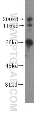 GRK6 Antibody in Western Blot (WB)