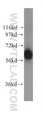 GTF3C5 Antibody in Western Blot (WB)