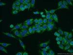 COX5A Antibody in Immunocytochemistry (ICC/IF)