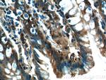 NQO1 Antibody in Immunohistochemistry (Paraffin) (IHC (P))