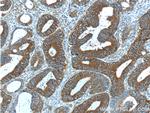 S100A16 Antibody in Immunohistochemistry (Paraffin) (IHC (P))