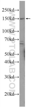 PRUNE2 Antibody in Western Blot (WB)