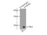 COX4I2 Antibody in Immunoprecipitation (IP)