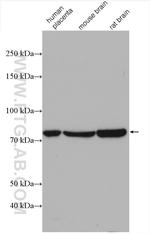 Calpain 2 Antibody in Western Blot (WB)