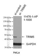 TRIM5 Antibody in Western Blot (WB)