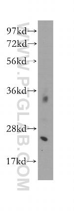 CALN1 Antibody in Western Blot (WB)