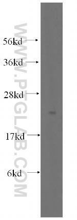 PTPMT1 Antibody in Western Blot (WB)