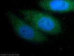 FGF18 Antibody in Immunocytochemistry (ICC/IF)