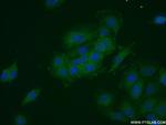 FRS2 Antibody in Immunocytochemistry (ICC/IF)