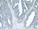 BubR1 Antibody in Immunohistochemistry (Paraffin) (IHC (P))