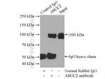 ASCC2 Antibody in Immunoprecipitation (IP)