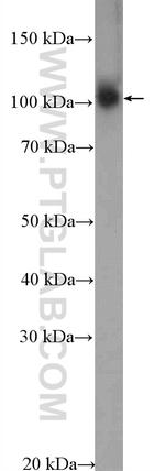 MED15 Antibody in Western Blot (WB)