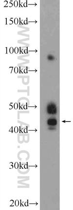 kazrin Antibody in Western Blot (WB)