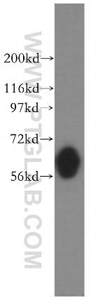 MPP6 Antibody in Western Blot (WB)