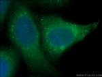 GRP78/BIP Antibody in Immunocytochemistry (ICC/IF)