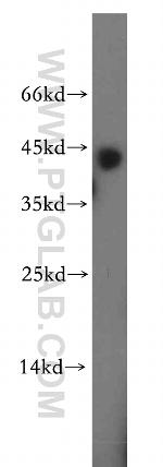 RGS5 Antibody in Western Blot (WB)