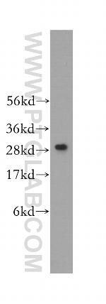 C1qA Antibody in Western Blot (WB)