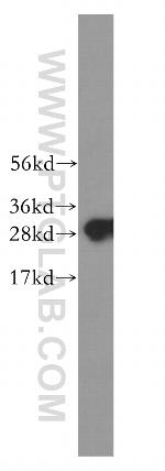 C1qA Antibody in Western Blot (WB)