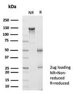 BATF2/SARI (Transcription Factor) Antibody in SDS-PAGE (SDS-PAGE)