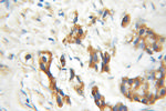 ENTPD6 Antibody in Immunohistochemistry (Paraffin) (IHC (P))