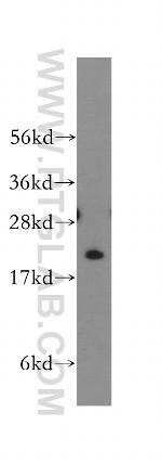 TNNI2 Antibody in Western Blot (WB)