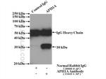 APH1A Antibody in Immunoprecipitation (IP)