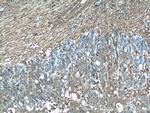 Gelsolin Antibody in Immunohistochemistry (Paraffin) (IHC (P))