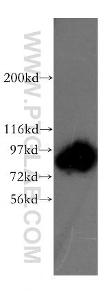 Gelsolin Antibody in Western Blot (WB)